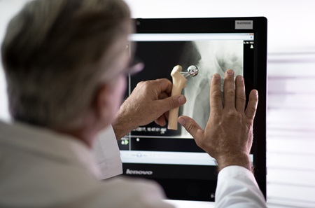 Orthopedic specialist examining hip x-ray to see if candidate for hip replacement surgery